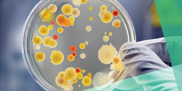 a gloved hand holding a petri dish with colourful orange and yellow spores