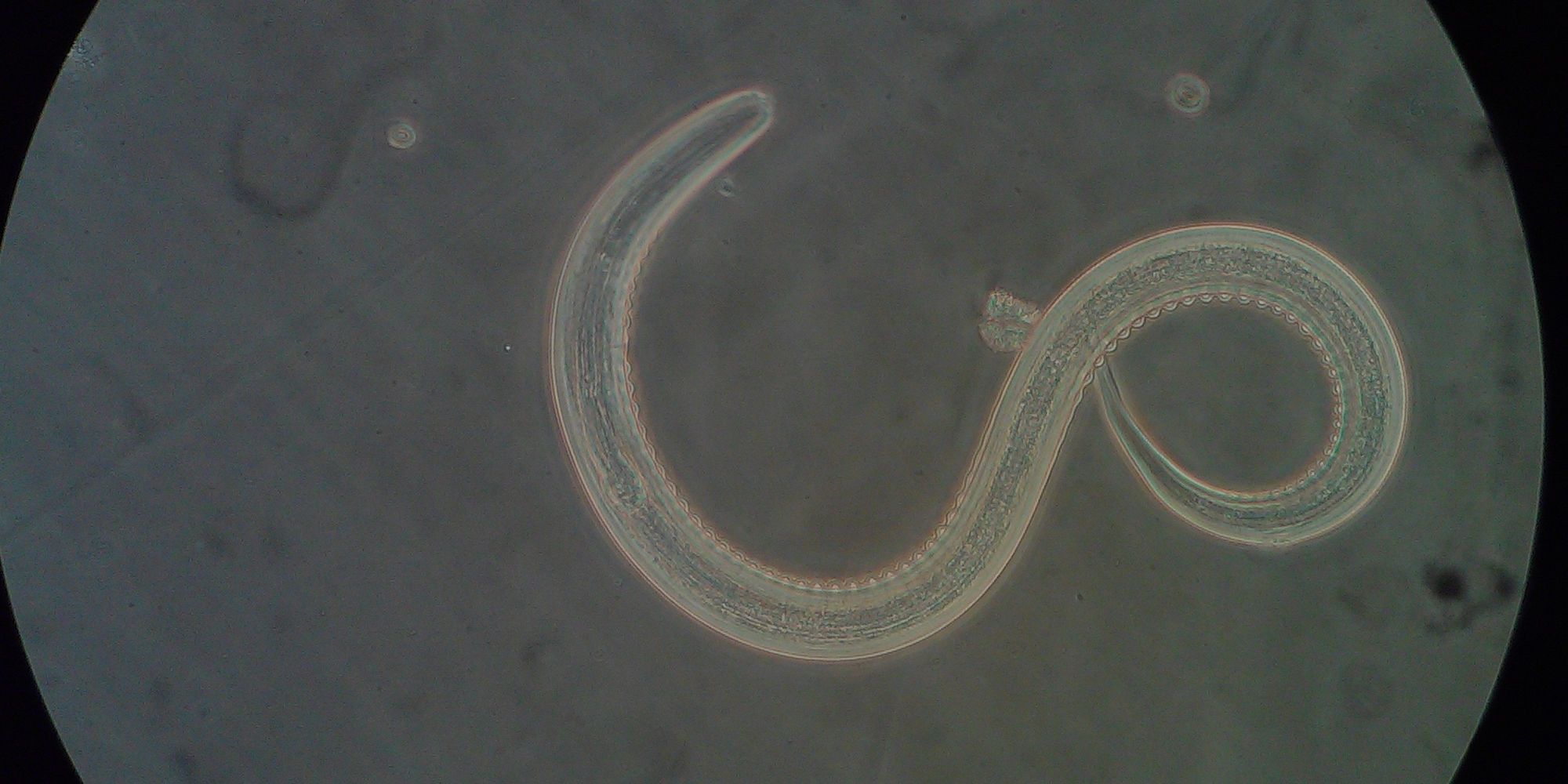 Microscopic parasite