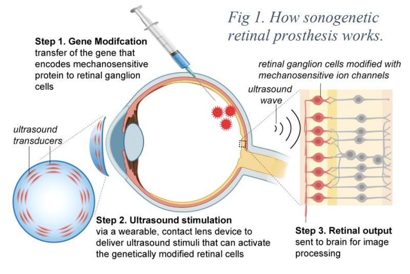 A diagram showing how sonogenetics works
