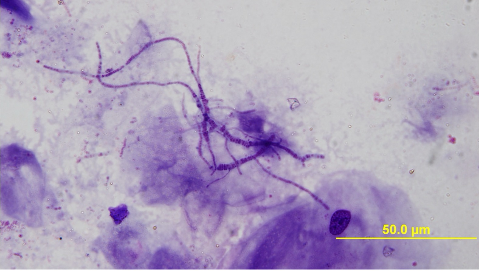 Figure 14.4. Classic ‘railroad track’ appearance of dermatophilosis on cytology