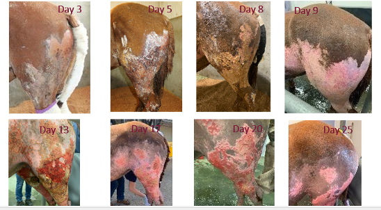 Figure 14.1 Progression of wounds following severe thermal injuries (3rd degree).